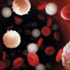 Leucemia - Por Arieldi Marrero Batista - Medicina para el Cuerpo