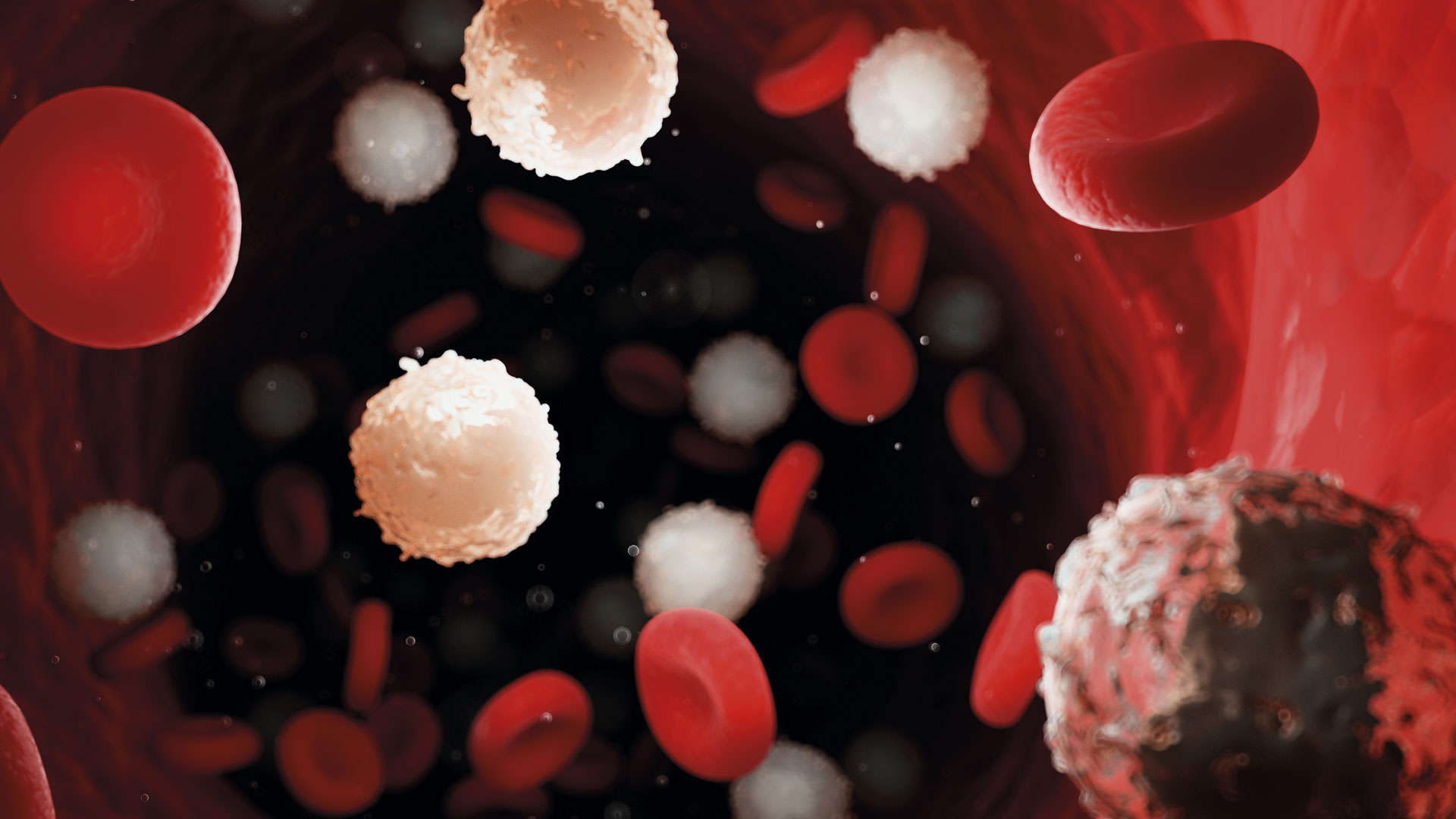 ¿Qué es Leucemia?